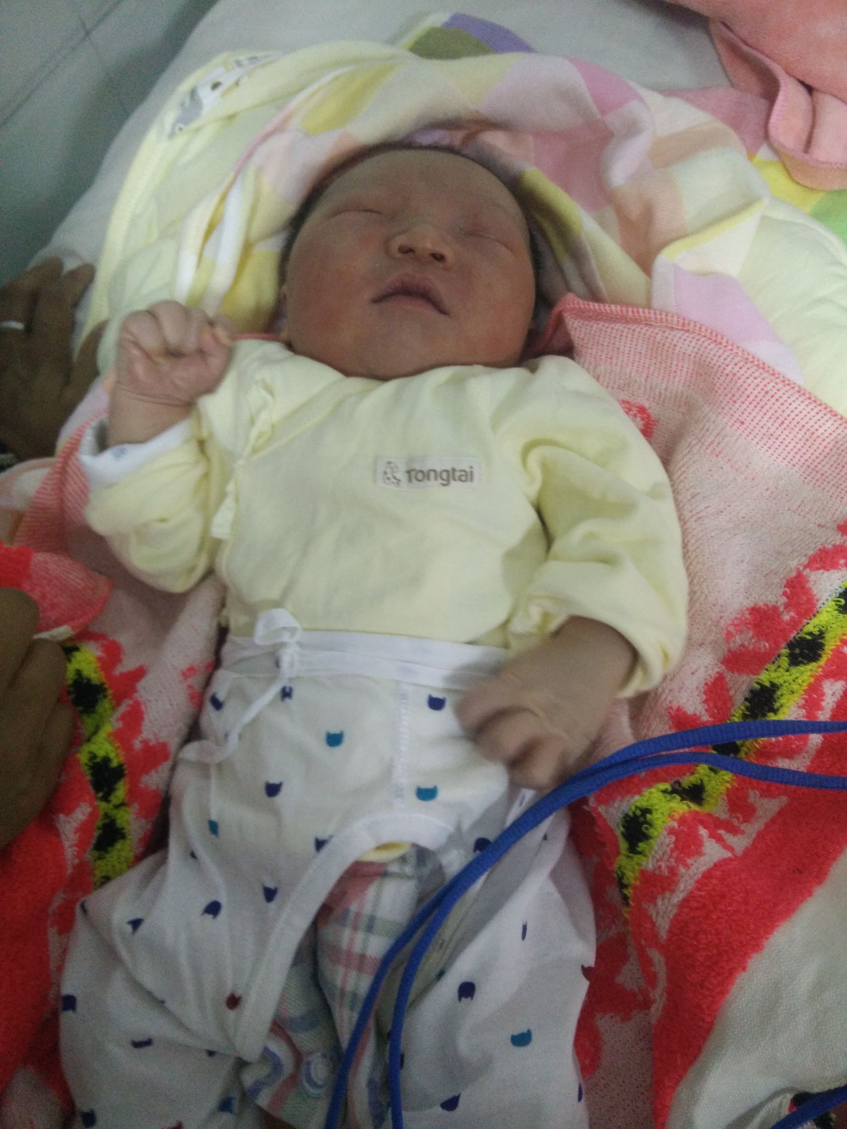 宝宝湿疹妈妈很着急,宝宝湿疹的正确防治方法