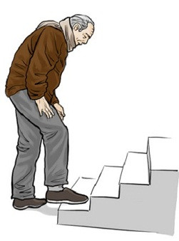 膝关节炎临床治疗讲座,膝骨关节炎中医诊疗指南解读