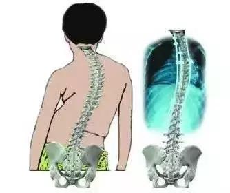 就医搜｜折磨蔡少芬、周董的“不死的癌症”是什么？（附名单）