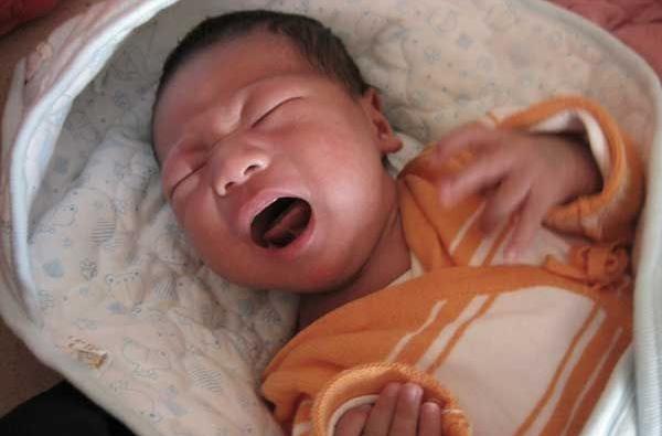 宝宝舌头w型是舌系带短吗,宝宝舌头w型一定要做手术吗