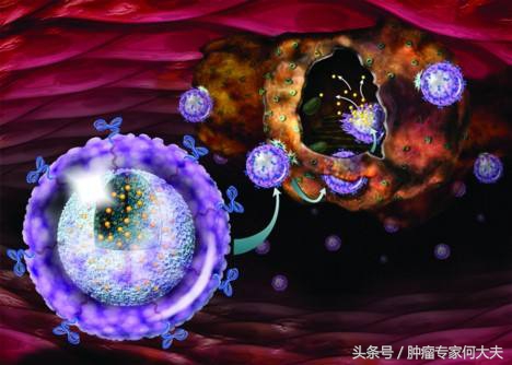 肺癌骨转移活了10年,肺癌脑转移骨转移活了10年