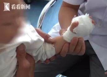 在手上扎针是不是可以治小孩挑食,小孩扎手指头治积食