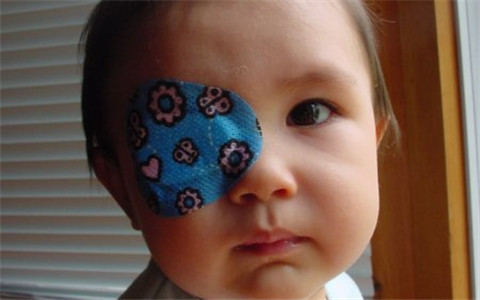 弱视有没有不治疗好了的,孩子弱视可以治好么