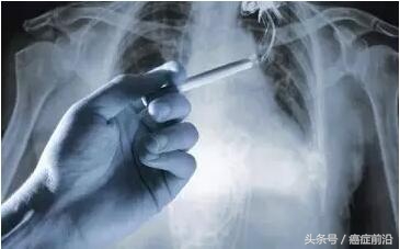 pd1抗体进行免疫治疗费用多少,pd-1抗体