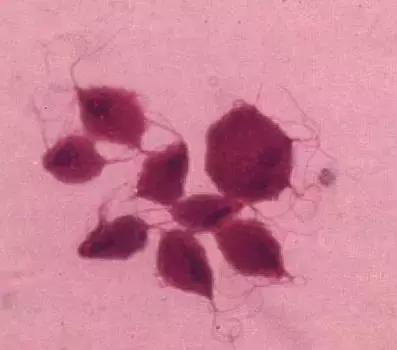 最新癌症疫苗已进入临床试验阶段,唯一可防可控可治的癌症