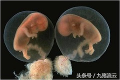 女性做人流没流干净，这对女性健康来说祸患无穷！