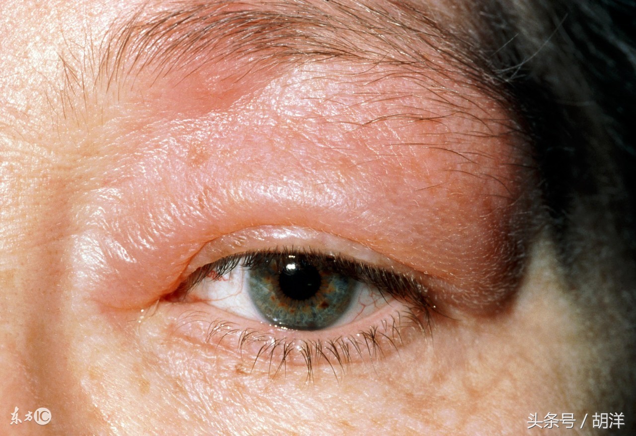 输液过程中常见的输液故障有,输液的关注事项有哪些