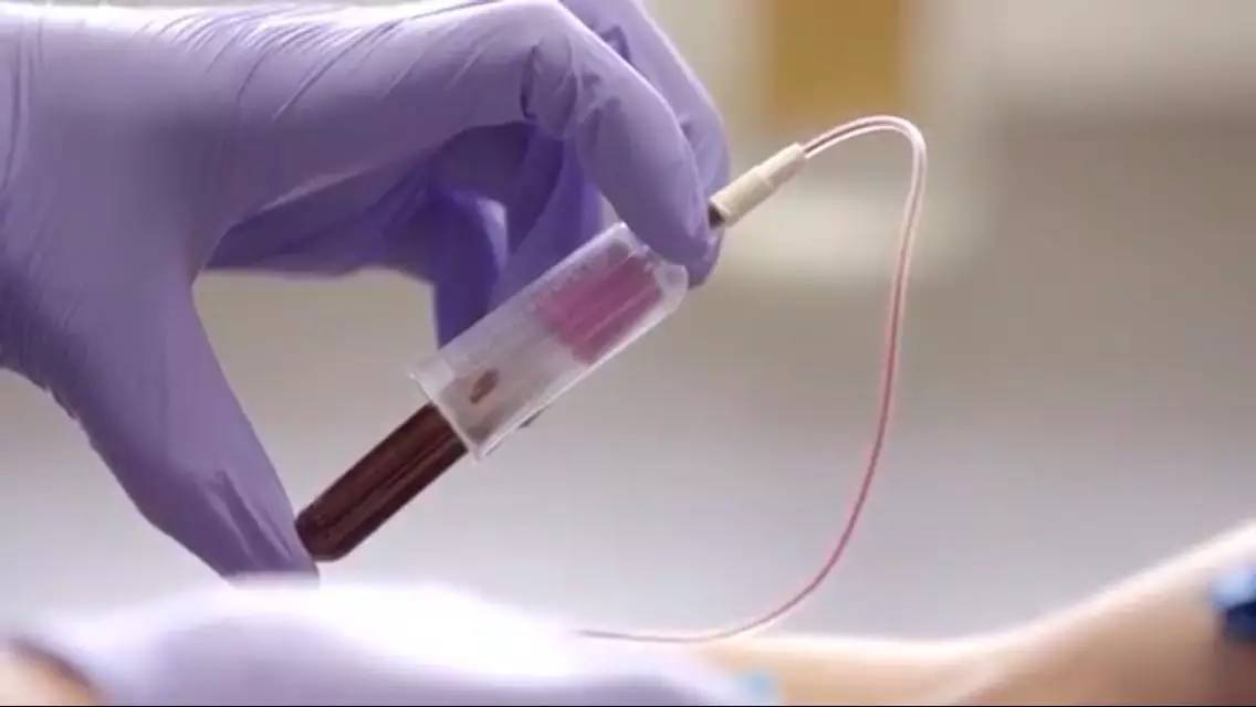 美国华盛顿大学开发出新款APP：通过智能手机自拍筛查胰腺癌！