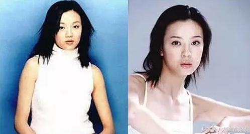 网曝林志玲因母亲生病身材暴瘦,林志玲被疑修脸