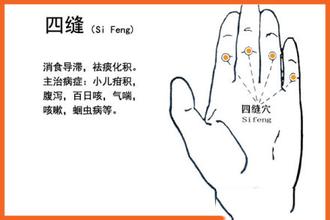 在手上扎针是不是可以治小孩挑食,小孩扎手指头治积食