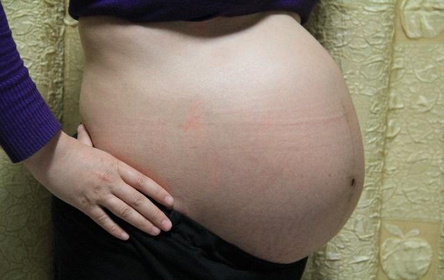 怀孕前一直吃药调理身体，突然怀孕还是双胞胎，创奇迹生下宝宝