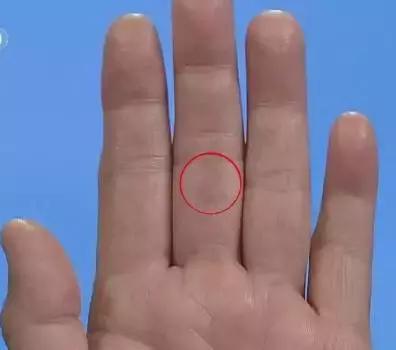 手上发紫中间发白,手上发紫发青还发痒是怎么回事