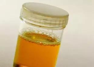 一泡尿就能看出你的肾好不好,第一泡尿如何看健康