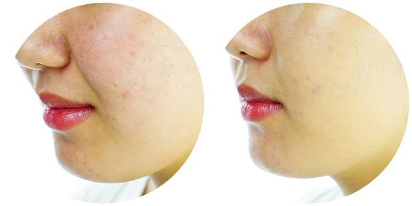 最好用的粉底是哪一款,粉底大测评平价干皮