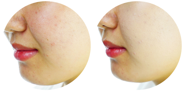 最好用的粉底是哪一款,粉底大测评平价干皮