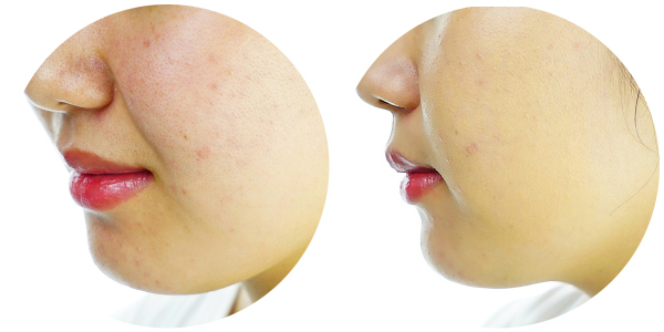 最好用的粉底是哪一款,粉底大测评平价干皮