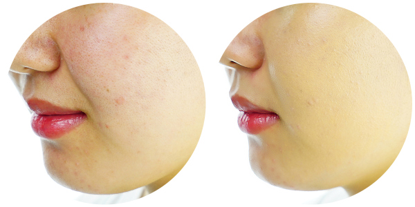 最好用的粉底是哪一款,粉底大测评平价干皮