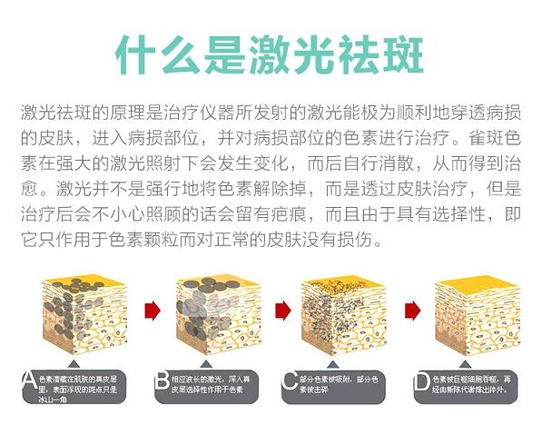 衡阳市激光祛斑,激光祛斑靠谱吗