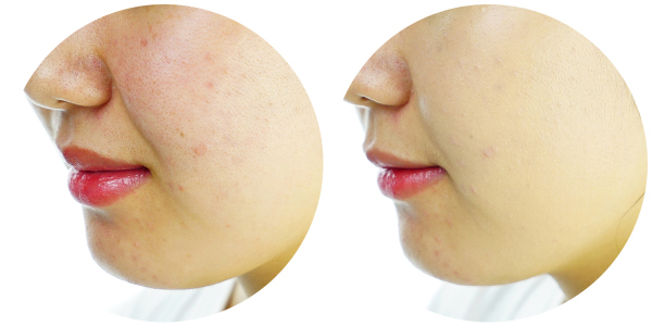 最好用的粉底是哪一款,粉底大测评平价干皮