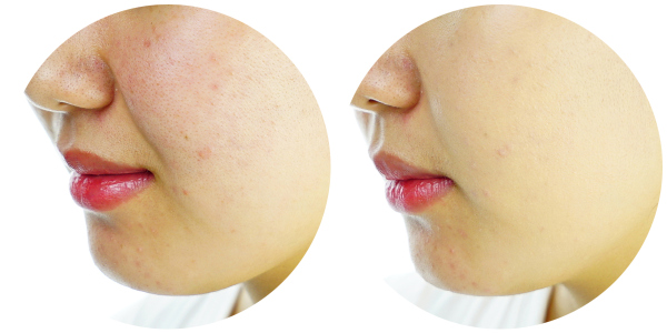 最好用的粉底是哪一款,粉底大测评平价干皮