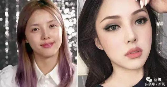 杨紫瘦了腿显得不纤细,杨紫变美之路脸怎么瘦的