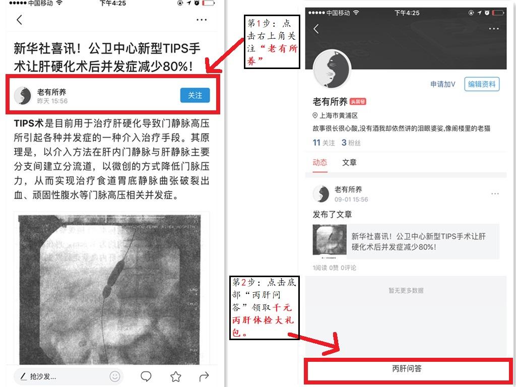 丙肝肝移植后能治愈吗,hcv感染存在部位