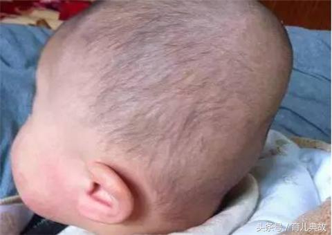 头扁的像铲子,头扁扁的像甲虫一样