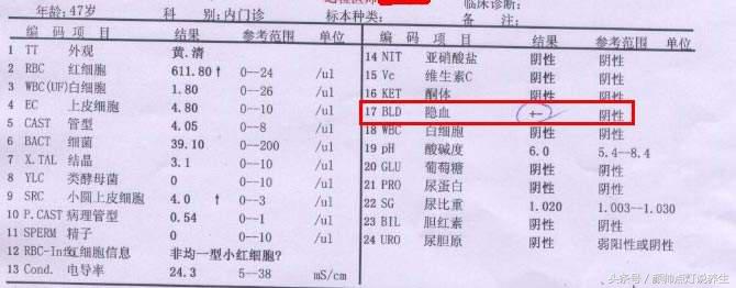 科普一张尿常规看懂你的肾,简单的尿常规能查出尿碘吗