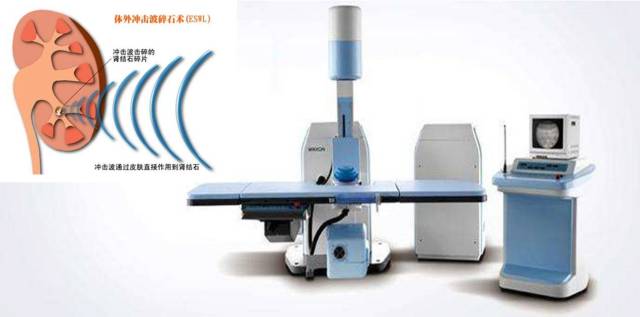 肾结石吃七种食物最好,用于治疗肾结石的药物