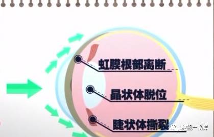 喜欢运动的人会怎么样,喜欢运动的人从外表可以看出来吗