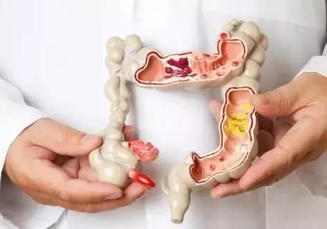 肠道堆积的垃圾多怎么调理,清除肠道垃圾的最好方法