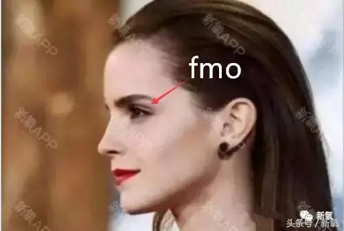 杨紫瘦了腿显得不纤细,杨紫变美之路脸怎么瘦的