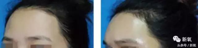 杨紫瘦了腿显得不纤细,杨紫变美之路脸怎么瘦的