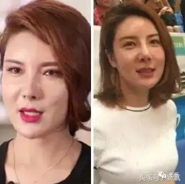 杨紫瘦了腿显得不纤细,杨紫变美之路脸怎么瘦的