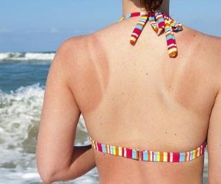 军训怎么不变黑变白,军训晒黑了怎么快速变白