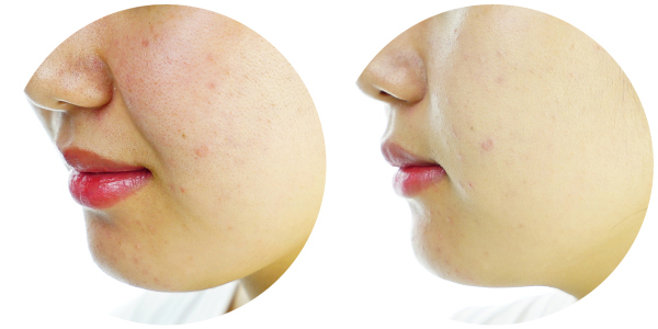 最好用的粉底是哪一款,粉底大测评平价干皮