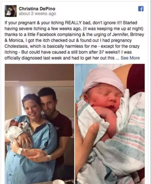 孕期吓到自己会影响胎儿吗,科普孕期痒