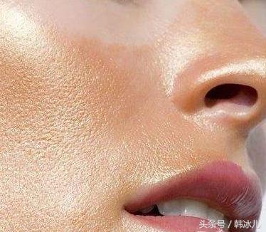 反复长痘痘的原因及解决方法,长痘痘是五种原因引起的