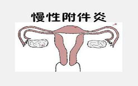 附件炎是因为什么而产生的呢,附件炎会影响受孕吗