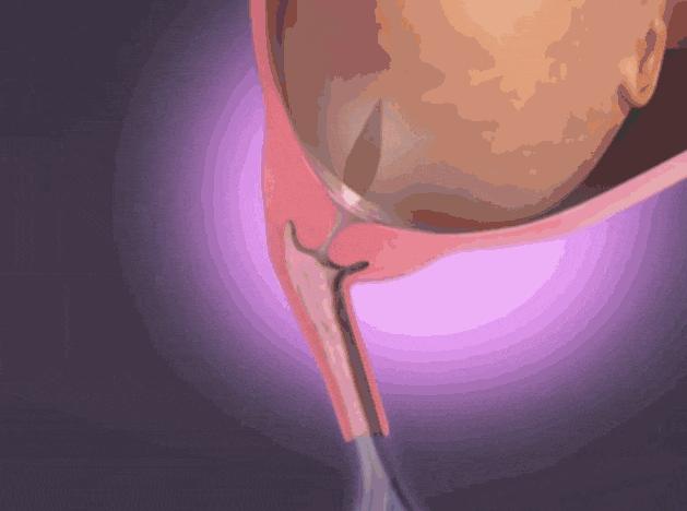 顺产到底有多疼看完你就知道了,顺产到底有多痛看完扎心了