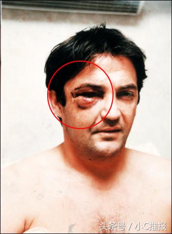 足球场上十大惨烈瞬间,足球场受伤瞬间图片