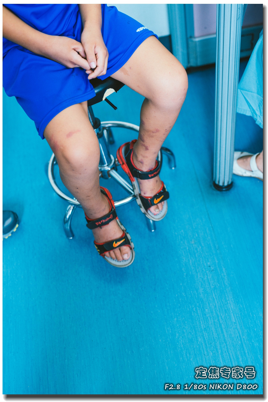 孩子肚子疼关节痛，等皮肤出了斑点才发现原来被它给骗了