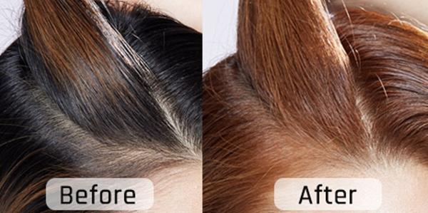 尴尬期后面的头发厚怎么办,发根尴尬期