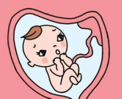 可以自由选择顺产和剖腹产吗,顺产选择无痛分娩好吗