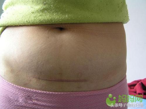 产妇要当心这4点,产妇要关注的3大问题