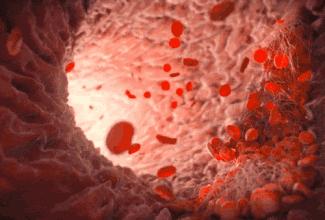 血管洗个澡健康活到老,血管洗刷刷