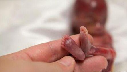 去医院流产之后要经历哪些步骤,孕70天流产哪种流产方式最好