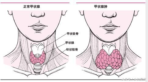 余杭区最新确诊人数一共有几例,余杭疾病