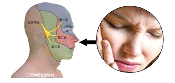 中医治疗鼻子肉疼,中药粉塞鼻治面瘫绝招