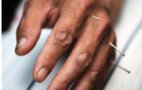 中风后遗症胳膊抬不起来针灸配穴,舒氏针灸中风后遗症的特效穴位